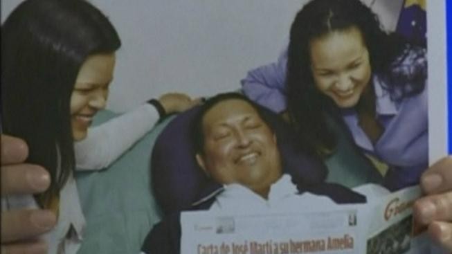 V médiích se objevily první Chávezovy snímky po prosincové operaci