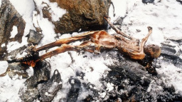Ötzi trpěl paradentózou. Měl zkažené zuby