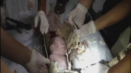 Aktualizováno: Matka spláchla dítě do záchodu, z roury ho museli vyřezávat