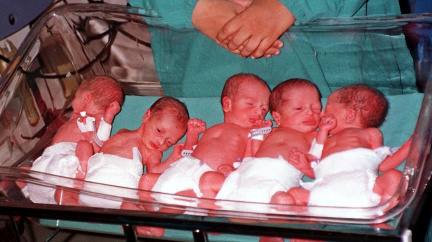 První česká paterčata jsou na světě. Rodička i děti jsou zdravé