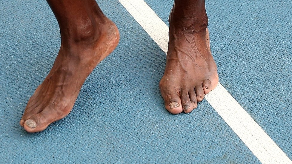 Kde má boty?! Tyhle nohy patří hvězdě