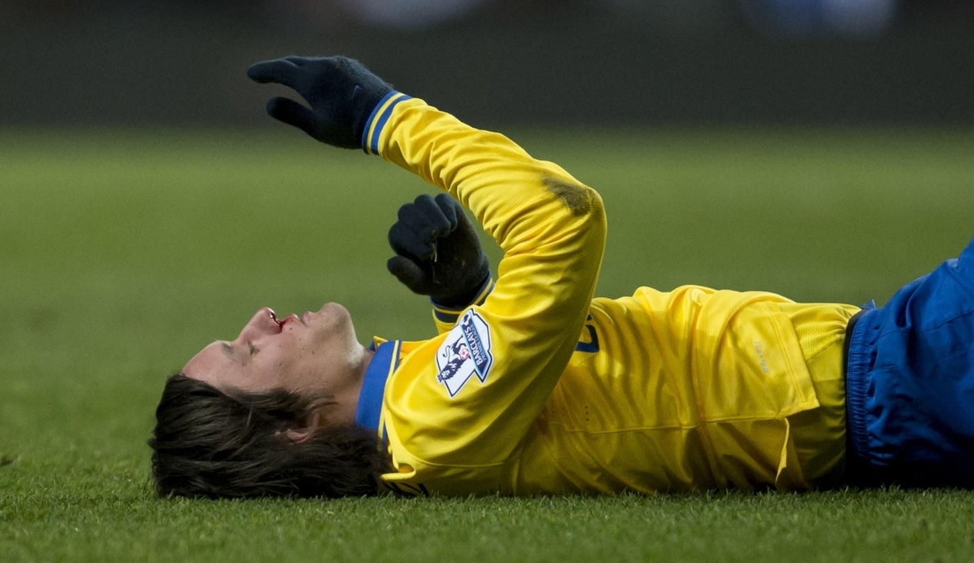 Rosický má zlomený nos. Vypadá špatně, říká kouč