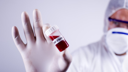 V USA zemřel muž nakažený ebolou