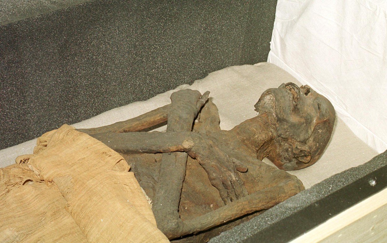 Vědci napodobili Egypťany, podle jejich návodu mumifikovali nohu
