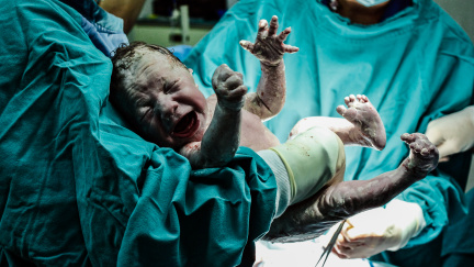 Komentář: Kdo má větší právo rozhodovat za dítě? Justice ve vleku války lékařů a rodičů