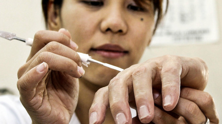 Umělý malíček na míru. Napravení gangsteři ho potřebují, aby začali nový život