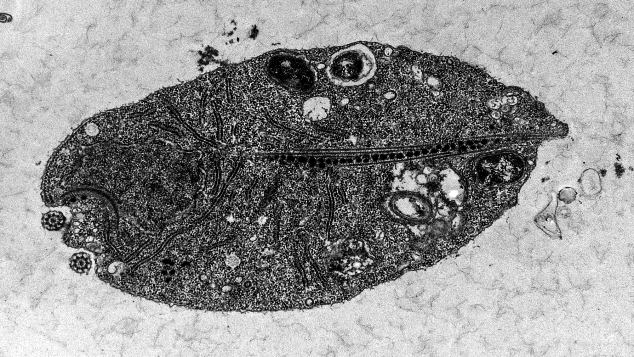 Přelomový objev českých vědců: První prvok bez mitochondrií