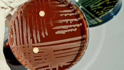 Češi přišli na nový způsob výroby antibiotik. Mají být mnohem účinnější