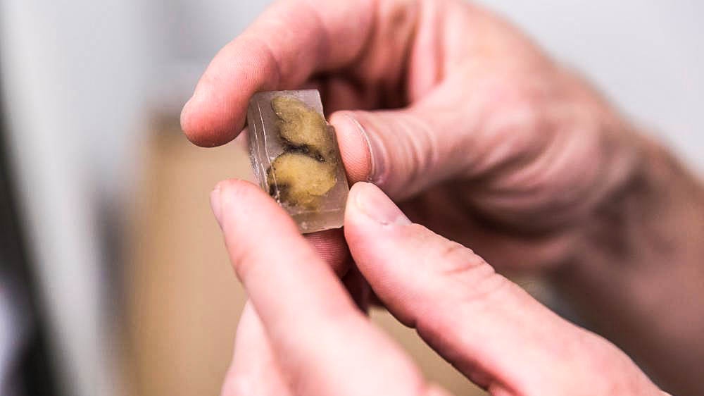 Jaká tajemství skrývají stoleté nádory? Lékařům se podařilo nahlédnout do jejich genomu