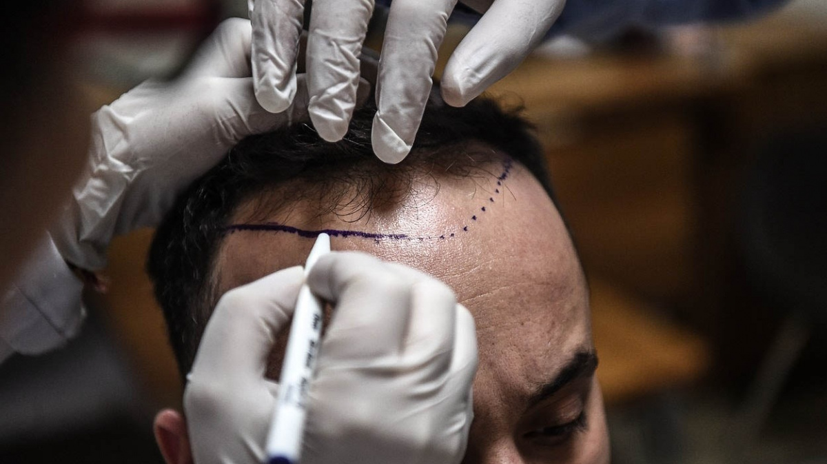 Čím Istanbul vábí plešaté muže?