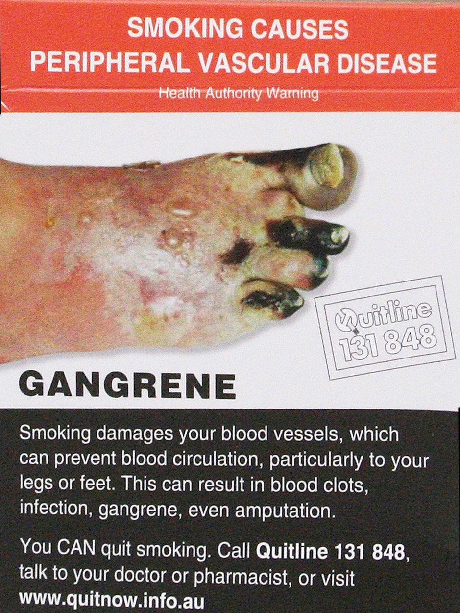 Varovné obrázky na krabičkách cigaret