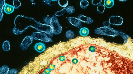 Čeští vědci zjistili, jak jeden běžný virus snižuje inteligenci