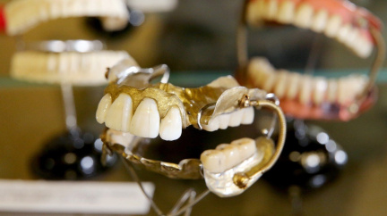 Nejlepší protézy? Zuby vojáků padlých u Waterloo