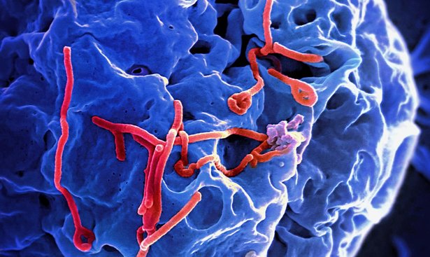 profimedia-0206985093ebola2