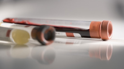 Za minulý rok v ČR přibylo 251 pacientů s HIV, o 29 více než předloni