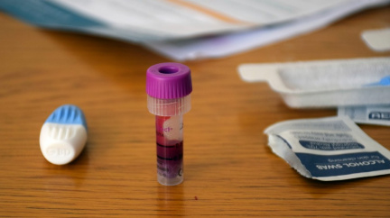 Stát připravuje celorepublikovou studii na koronavirové protilátky, chce zapojit tisíce lidí