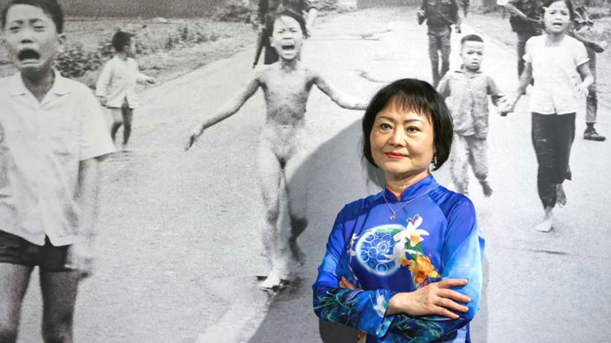 „Napalmová dívka“ je konečně bez jizev. Padesát let po útoku