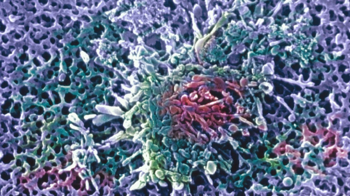 V Evropě se objevily případy zápalů plic jako v Číně