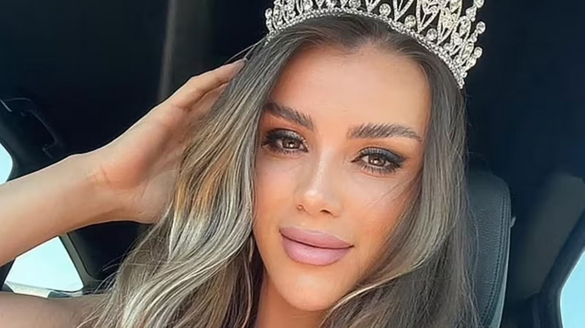 Miss Europe tragicky po smrti: Opilá se snažila utéct policii