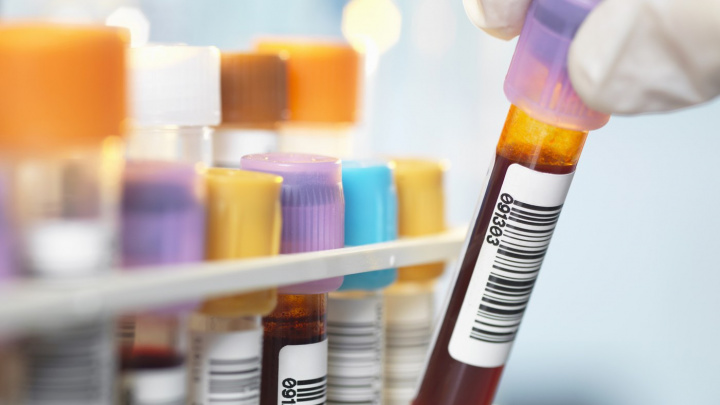Japonsko přepisuje dějiny medicíny: Testuje revoluční vynález