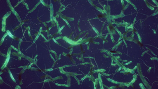 bakterie Vibrio cholerae