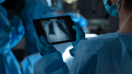 Budoucnost transplantací: Muž dostal plíce zvířete. Uhodnete kterého?