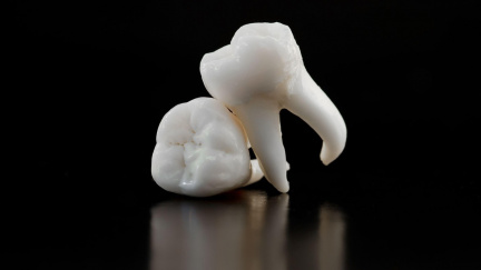 Voperovali mu zub do oka. Muž po 20 letech znovu vidí