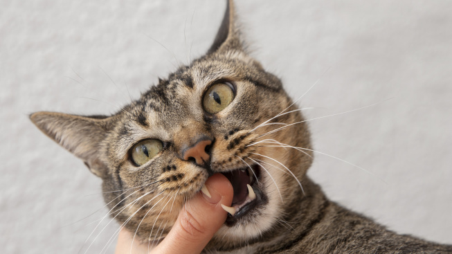 portrait-adorable-domestic-cat-biting-her-owner-s-finger (1)
