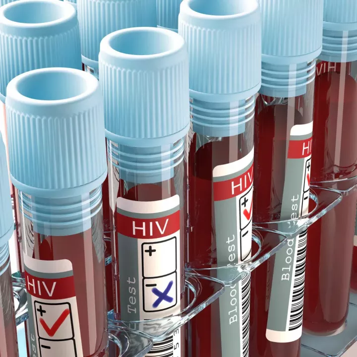 Nových případů HIV v Česku bylo loni 293, nejvíce v historii sledování