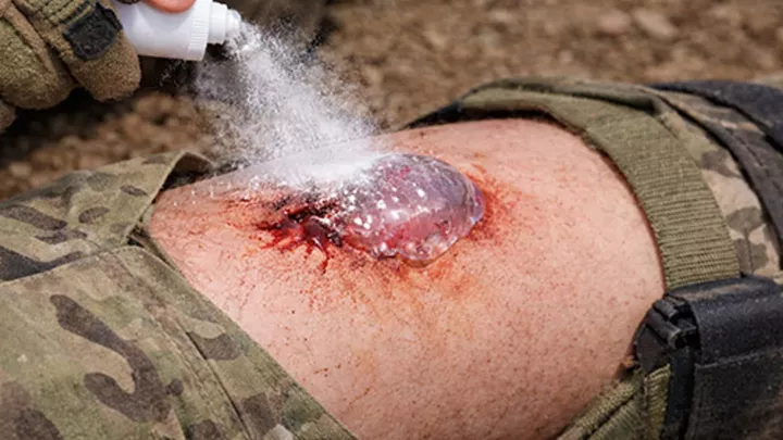 Stačí vteřina a krvácení je pryč. Korejci vyvinuli sprej, který může změnit medicínu