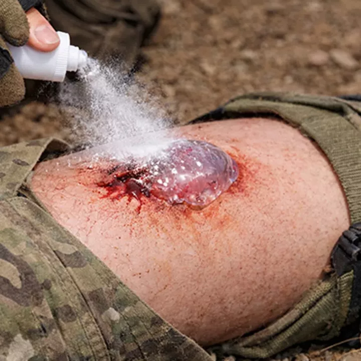 Stačí vteřina a krvácení je pryč. Korejci vyvinuli sprej, který může změnit medicínu