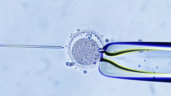 IVF