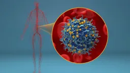 Zázrak v medicíně: Virus HIV se u pacienta úplně ztratil